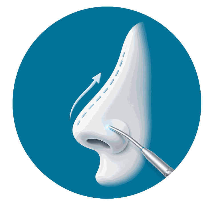 ico-cirugia-de-rinoplastia-estetica-y-funcional