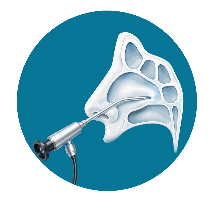ico-cirugia-de-tumores-nasosinusales