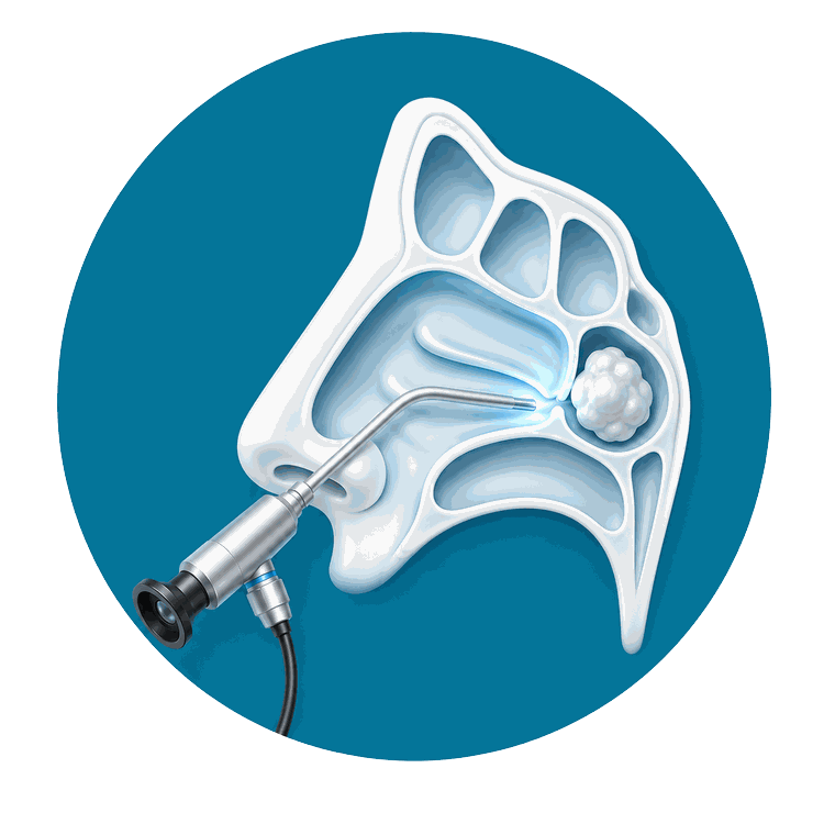 ico-cirugia-endoscopica-nasal-y-senos-paranasales